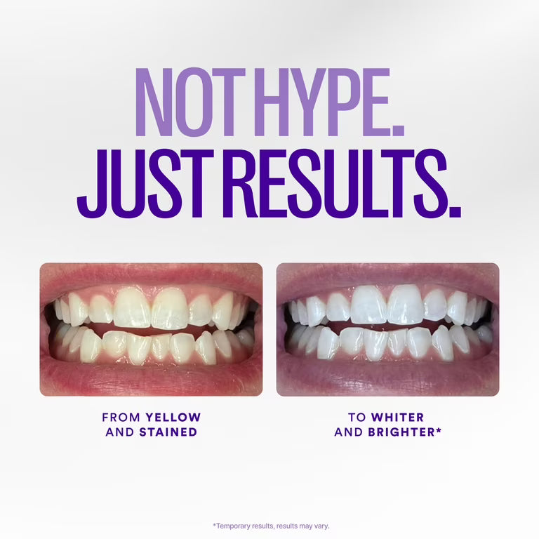NoVixor Teeth Whitening Strips